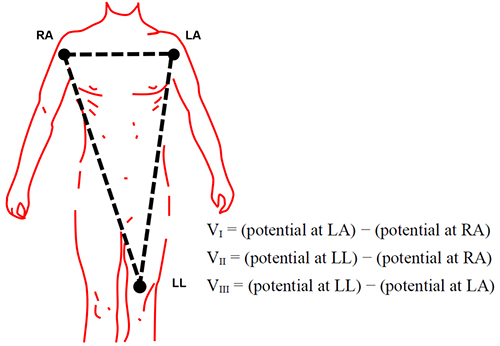 Diagram of ECG signals can be detected at many points on the body